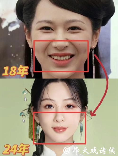 微博之夜上,我感觉杨紫的颜值完胜辛芷蕾。以前杨紫是娃娃脸,颜值平平。但这次微博之夜,她实现了完美逆袭 微博之夜上,我感觉杨紫的颜值完胜辛芷蕾。以前杨紫是娃娃脸,颜值平平。但这次微博之夜,她实现了完美逆袭